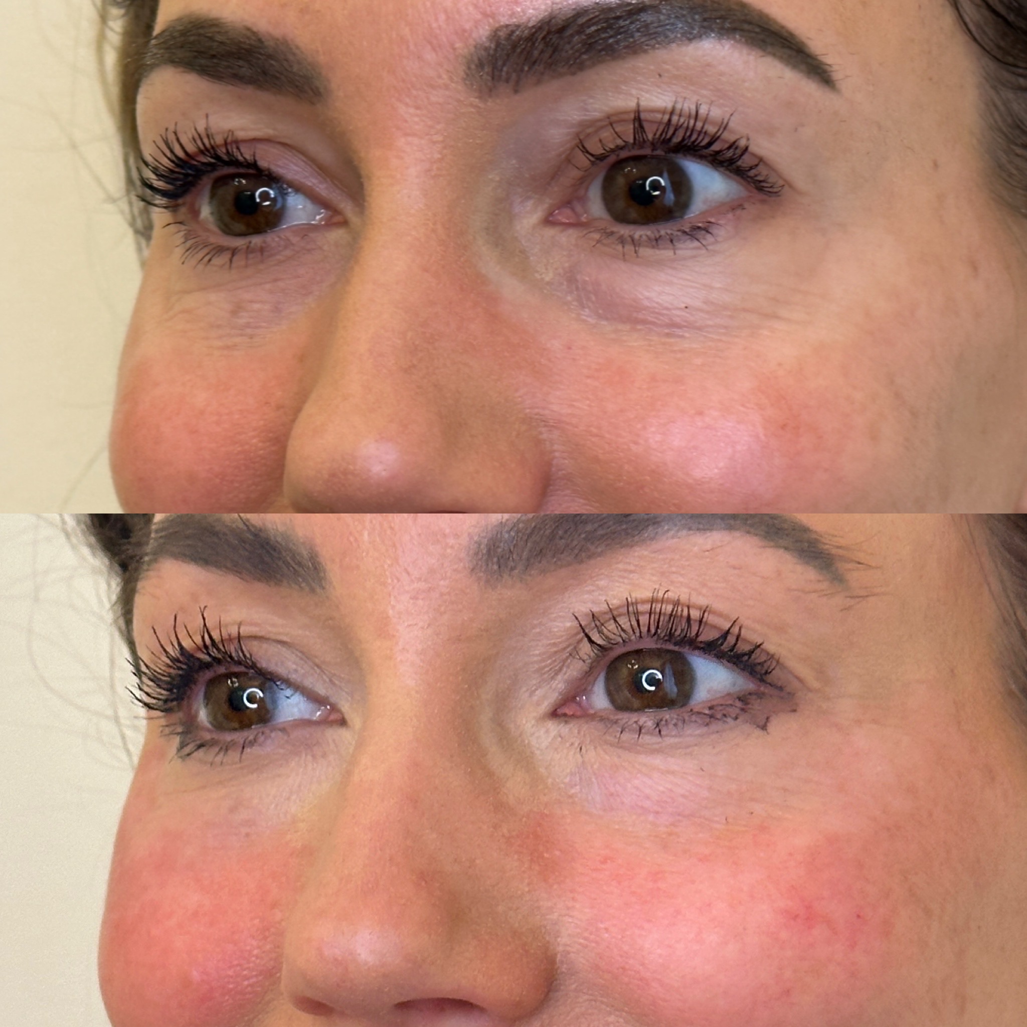 Facial Harmonisation 1