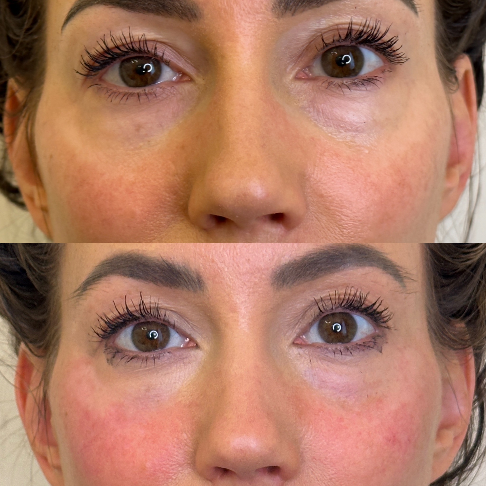 Facial Harmonisation 2